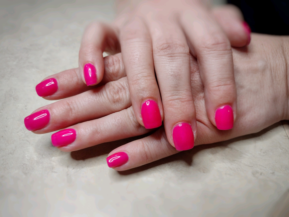 R/R Structured Gel