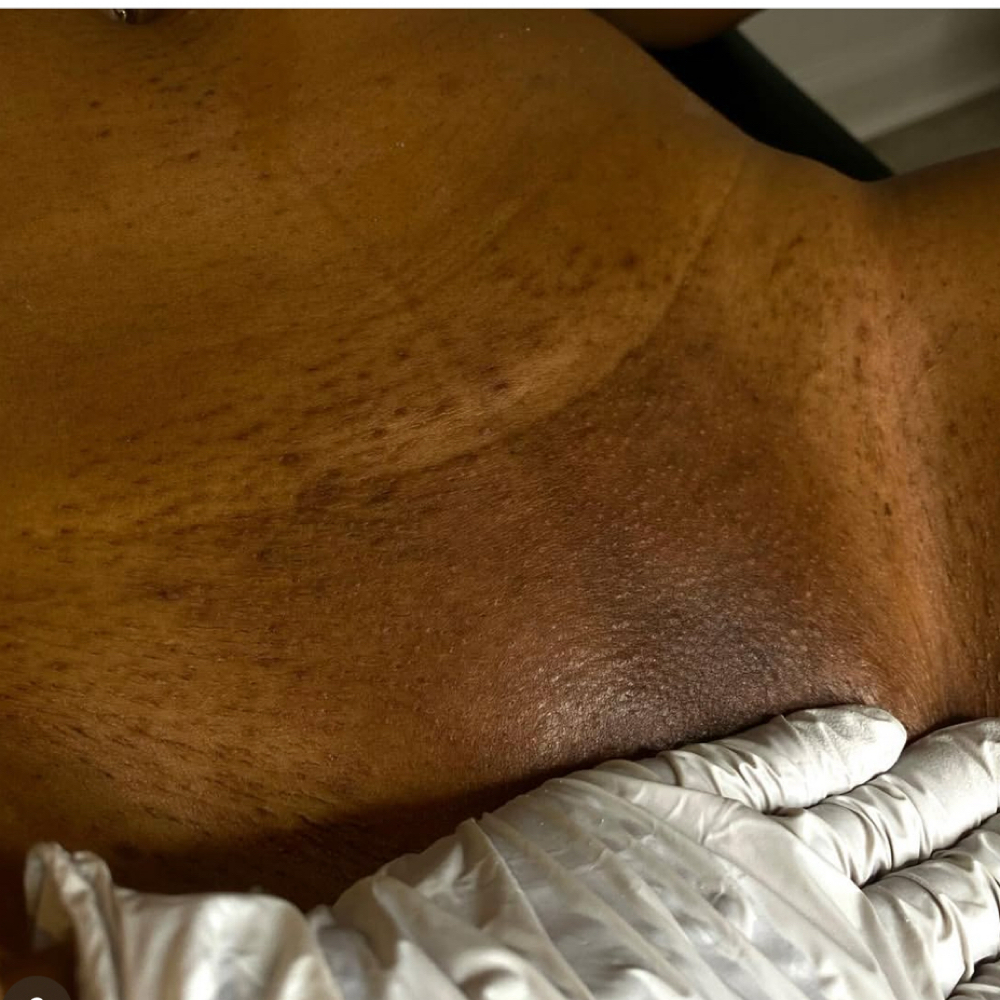 Bare Vajacial at Bare & Bloom Aesthetics Studio in Sugar Hill, GA