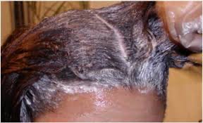Partial Relaxer (sides and back)*