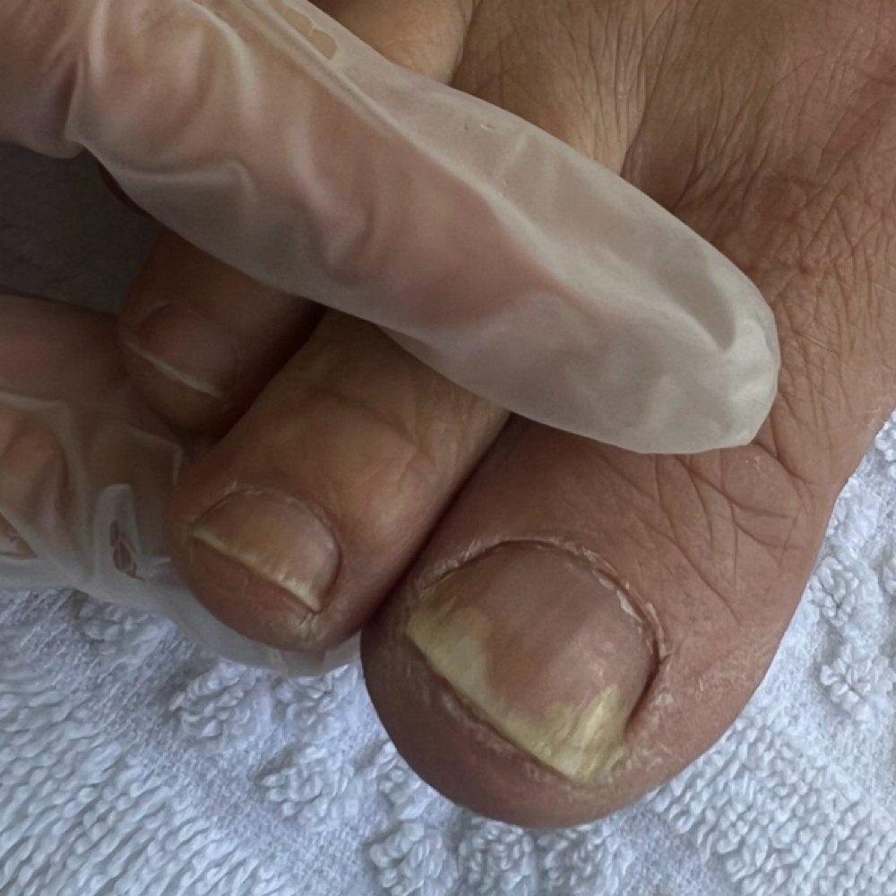 Level 1 -Advanced Foot Care $120 at Rosy’s Mobile Nail Care in Lakeland, FL