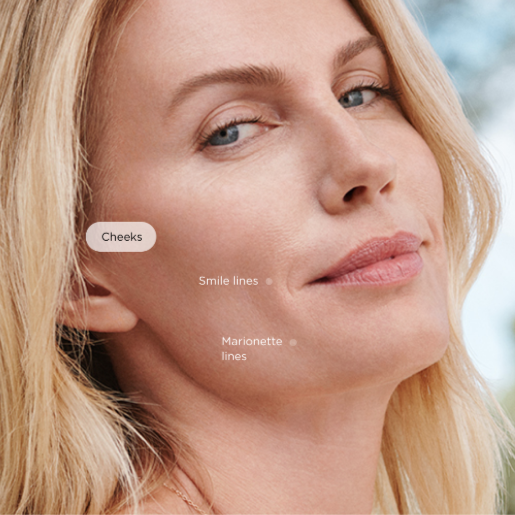 INJECTABLE – Sculptra at DM Laser Skin Care Solutions in Needham, MA
