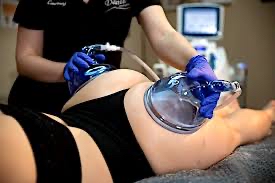 Non -Invasive Vacuum Butt Lift