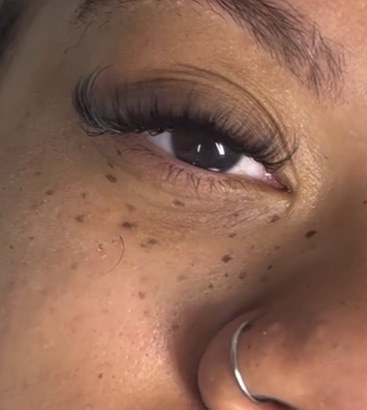 Annual Freckle Touch Up