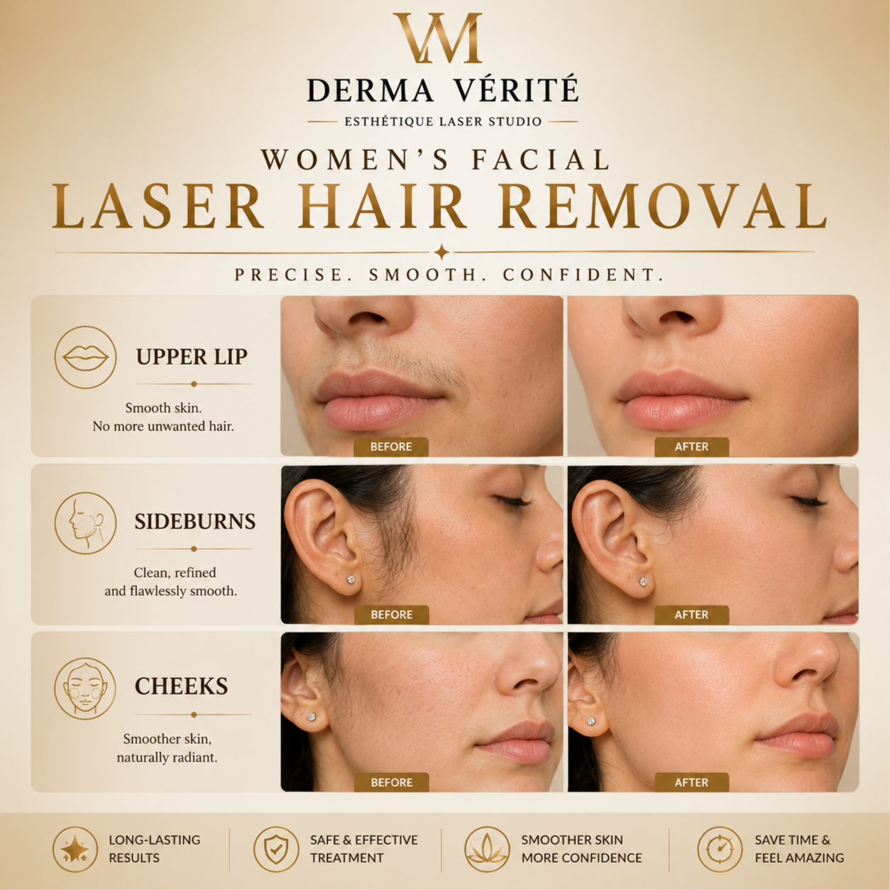 Laser Hair Removal-Upper Lip at Derma Verite Esthetique Laser Studio in Elmhurst, NY