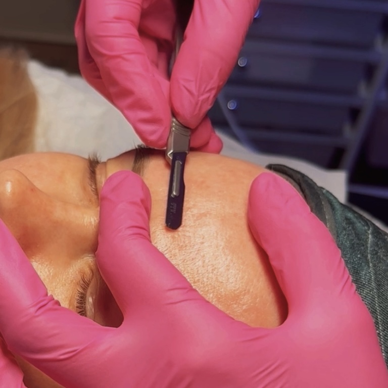 Dermaplaning Facial