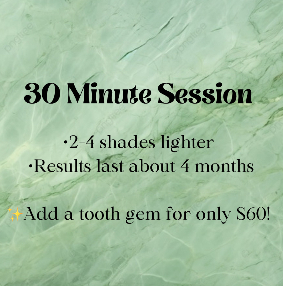 30 minute whitening session