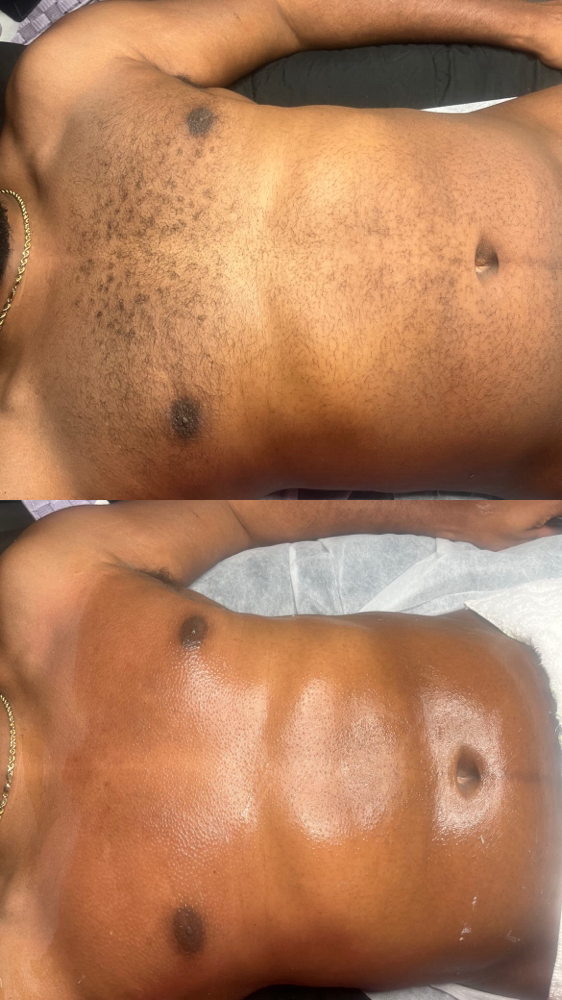 Mens Chest/Stomach Wax