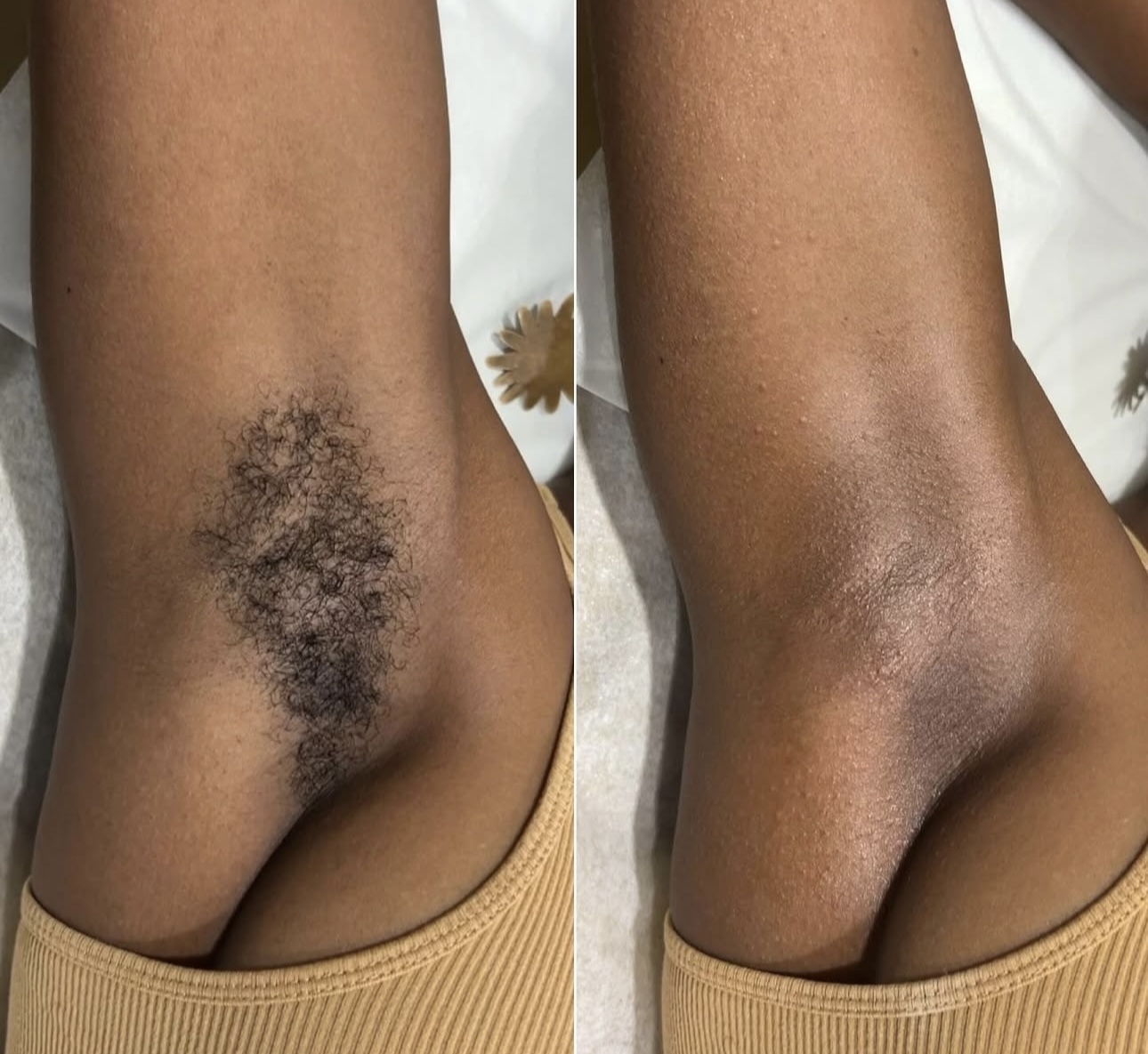 Underarm Wax