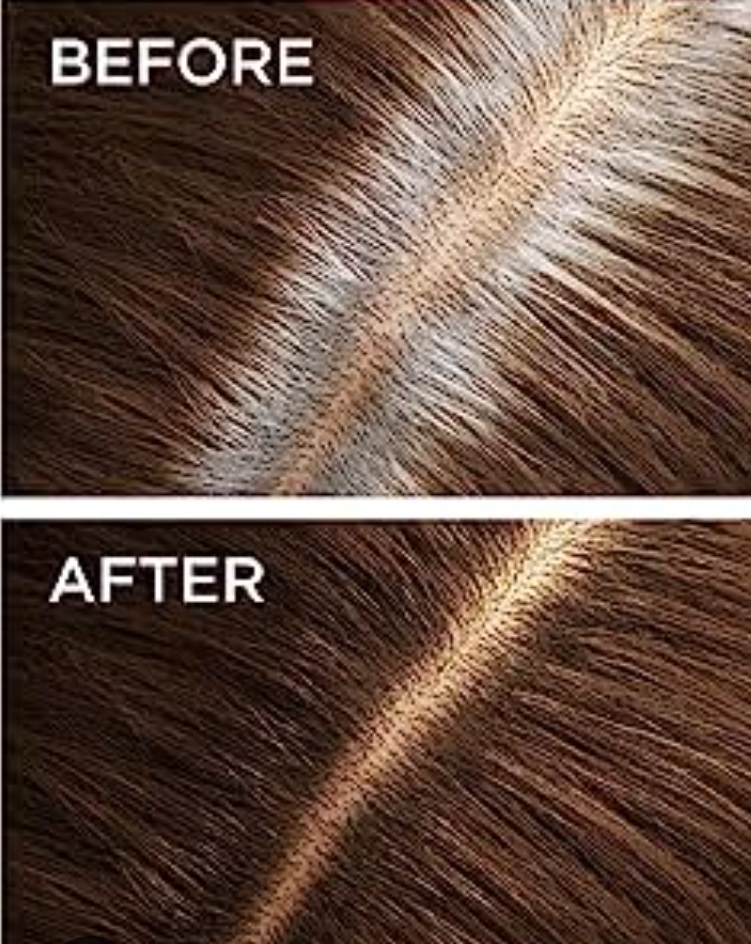 Root Touch Up