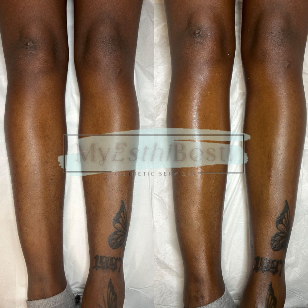 Leg Wax