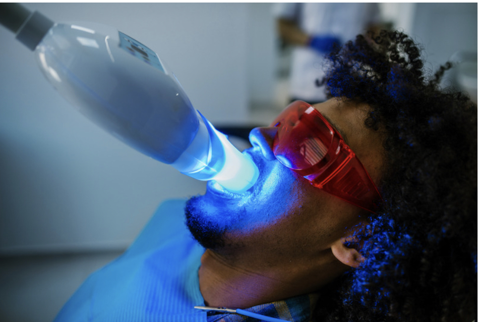 Platinum Teeth Whitening 60 Min