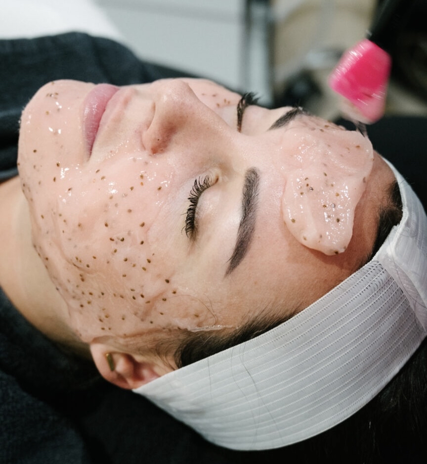 Dermaplaning with Hydrojelly Mask