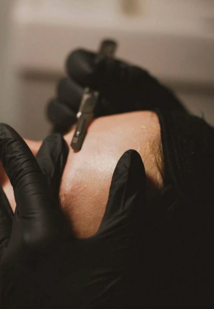 DERMAPLANE & DECOMPRESS FACIAL at Kay The Esthi in Prescott Valley, AZ