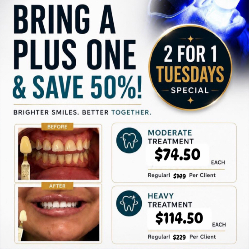 TUESDAY 2for1•Heavy▫️2      clients at Sirius Glow Teeth Whitening in Pasadena, TX