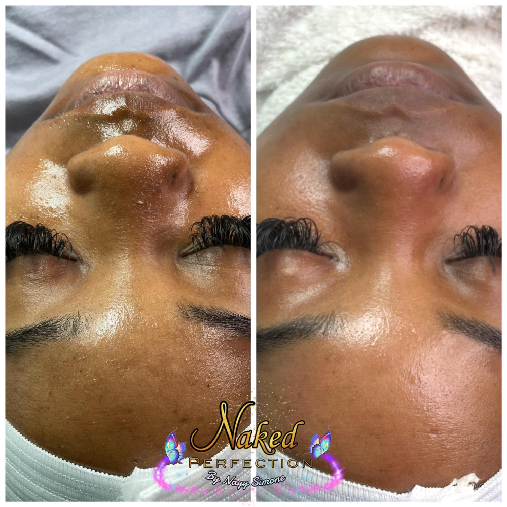 Deep Pore Cleanse