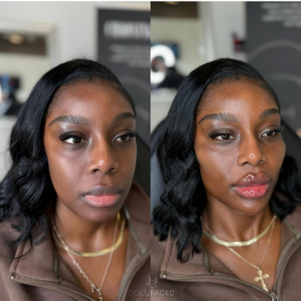 FACIAL BALANCING SCULPT PACKAGE at DOLLFACED Inc in Queens, NY