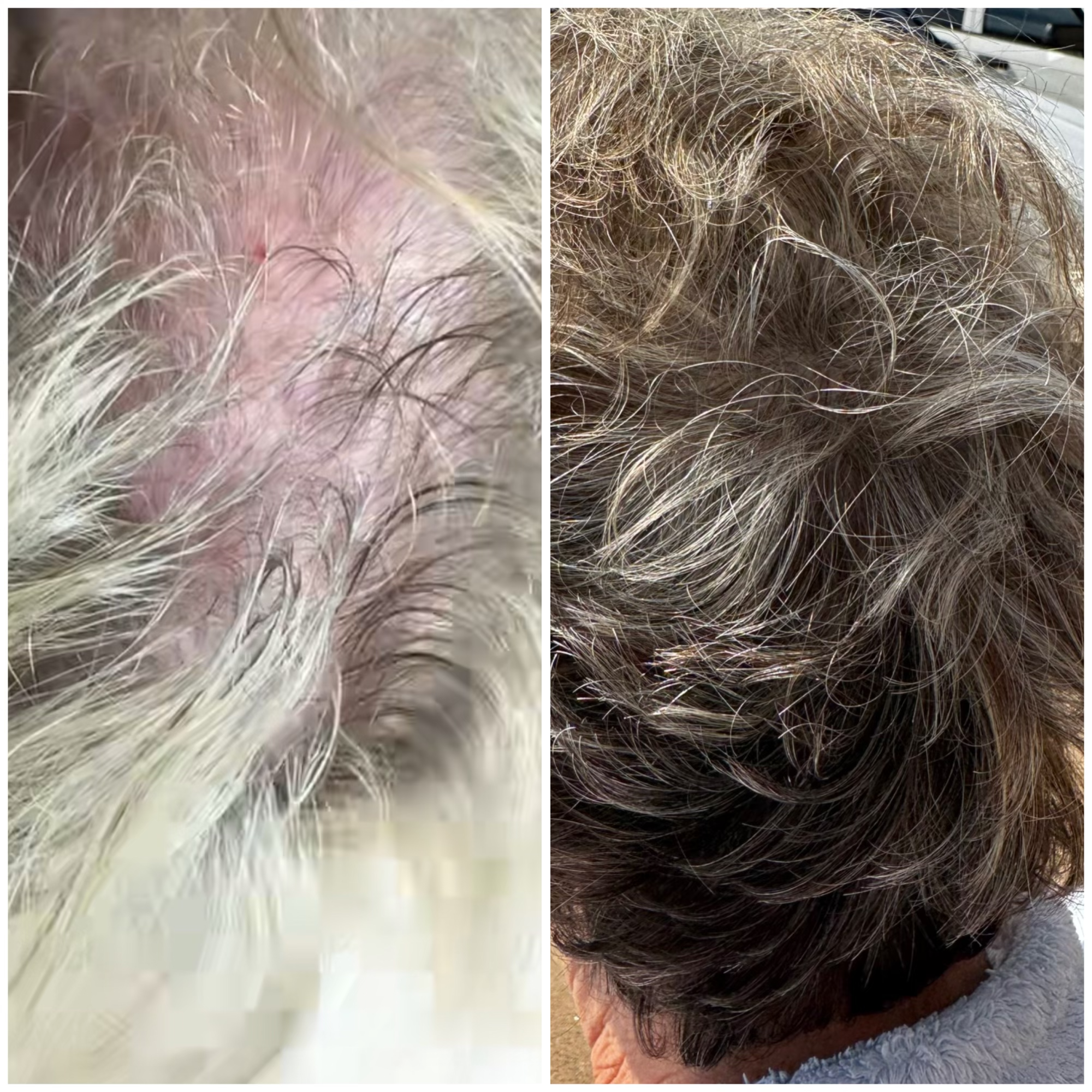 HAIR REJUV + Growth TRX