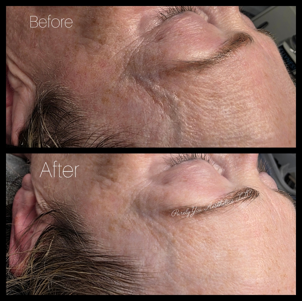 Aging Mask Facial Addon
