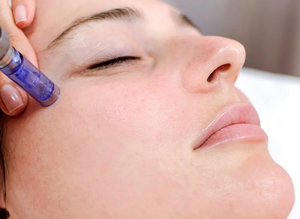 Under Eye Pigment Reduction