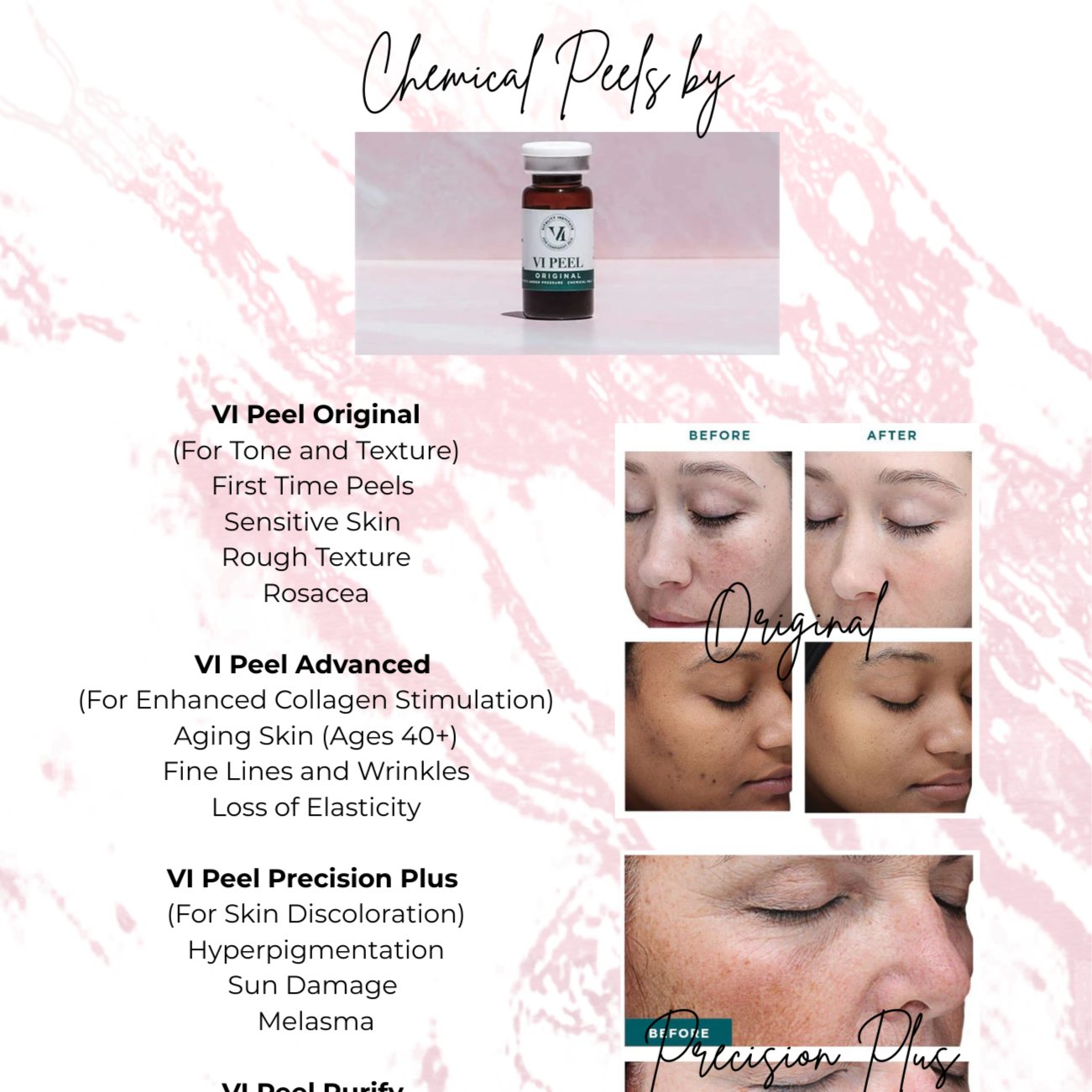 Chemical Peel (VI PEEL) at Leann Renee Aesthetics in St. Peter's, MO