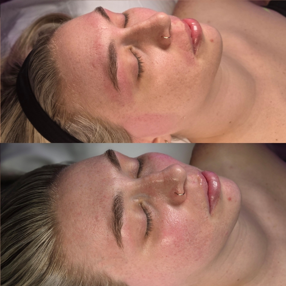 Korean Glow Facial (Premium) at Oregon Glow in Junction City, OR