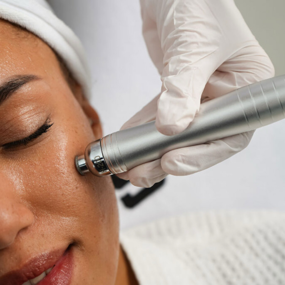 HydroDiamond Facial💎