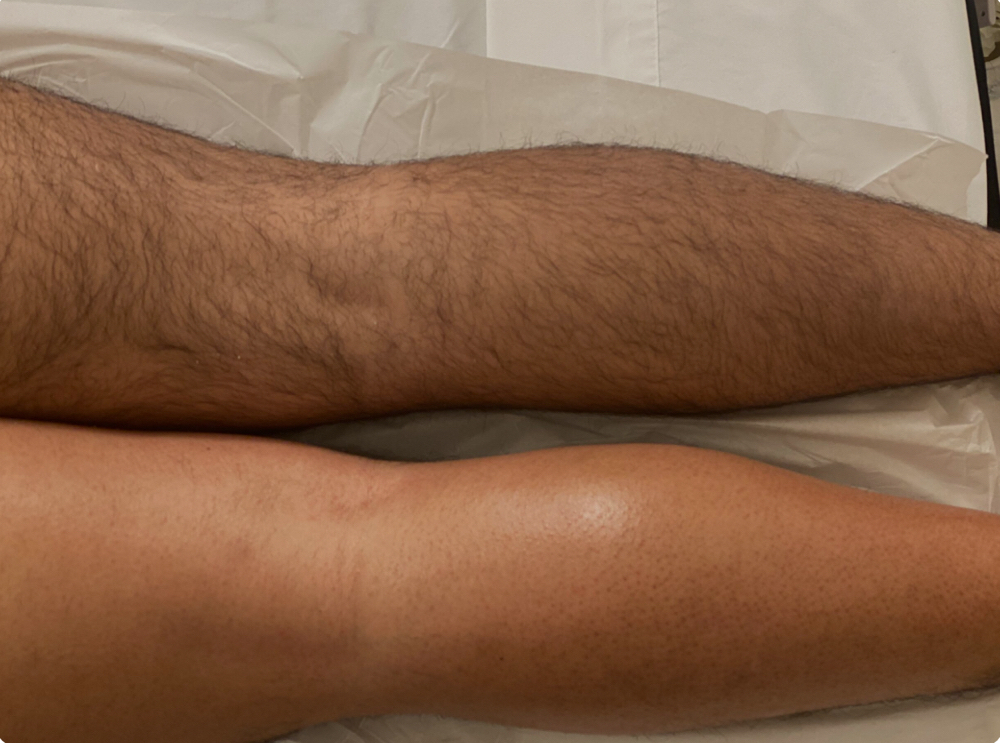 Male Full Leg Waxing