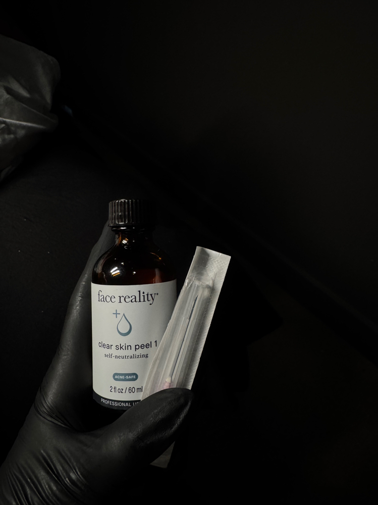 Acne Bootcamp Chemical Peel