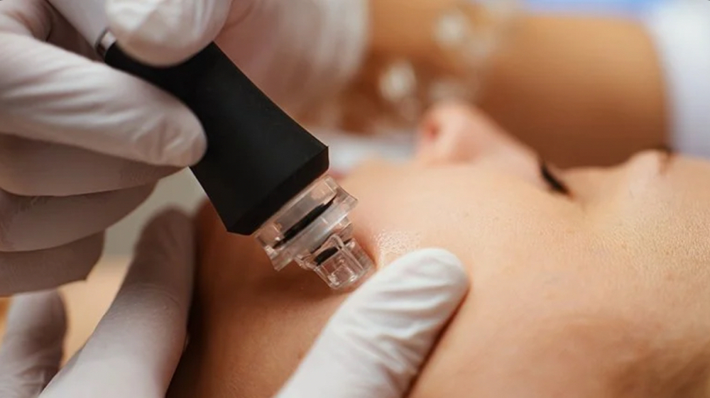 Hydrodermabrasion Facial