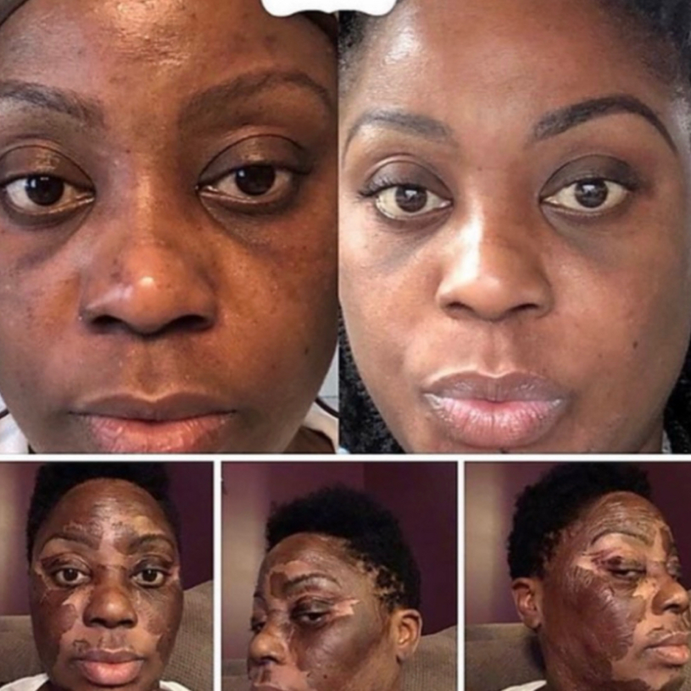 Elaine Brennan Skin Renewal Peel at Polished Pearl in Columbus, OH