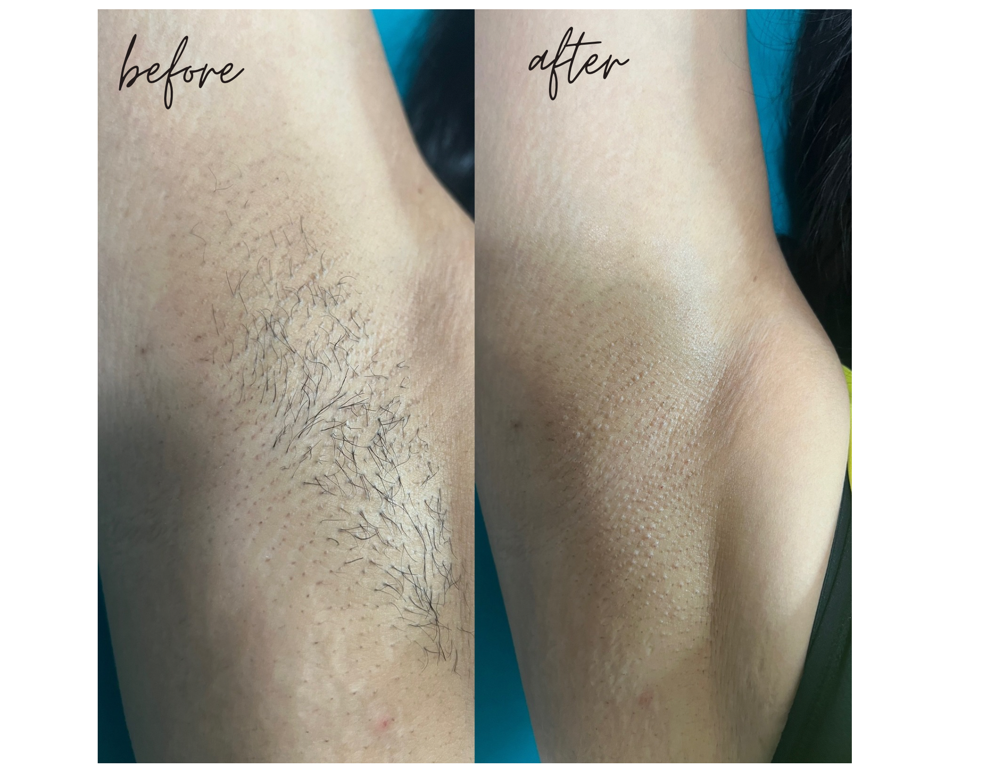 Underarm Wax