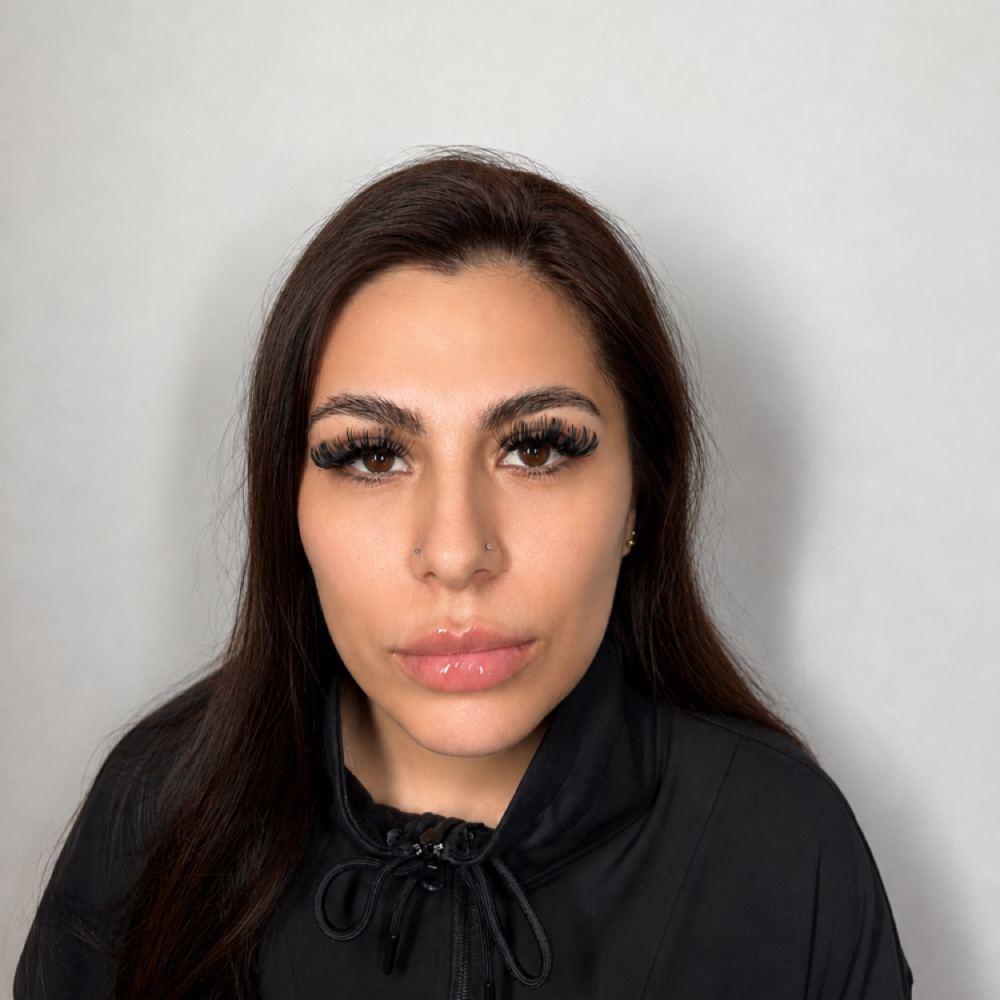 Dark Circle Undereye Skinbooster at Eluxy Aesthetics in Arlington, TX