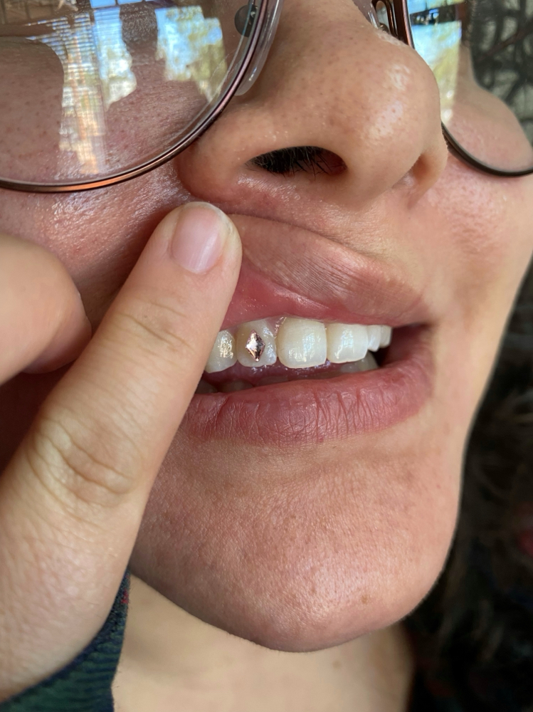 Birthstone Tooth Gem