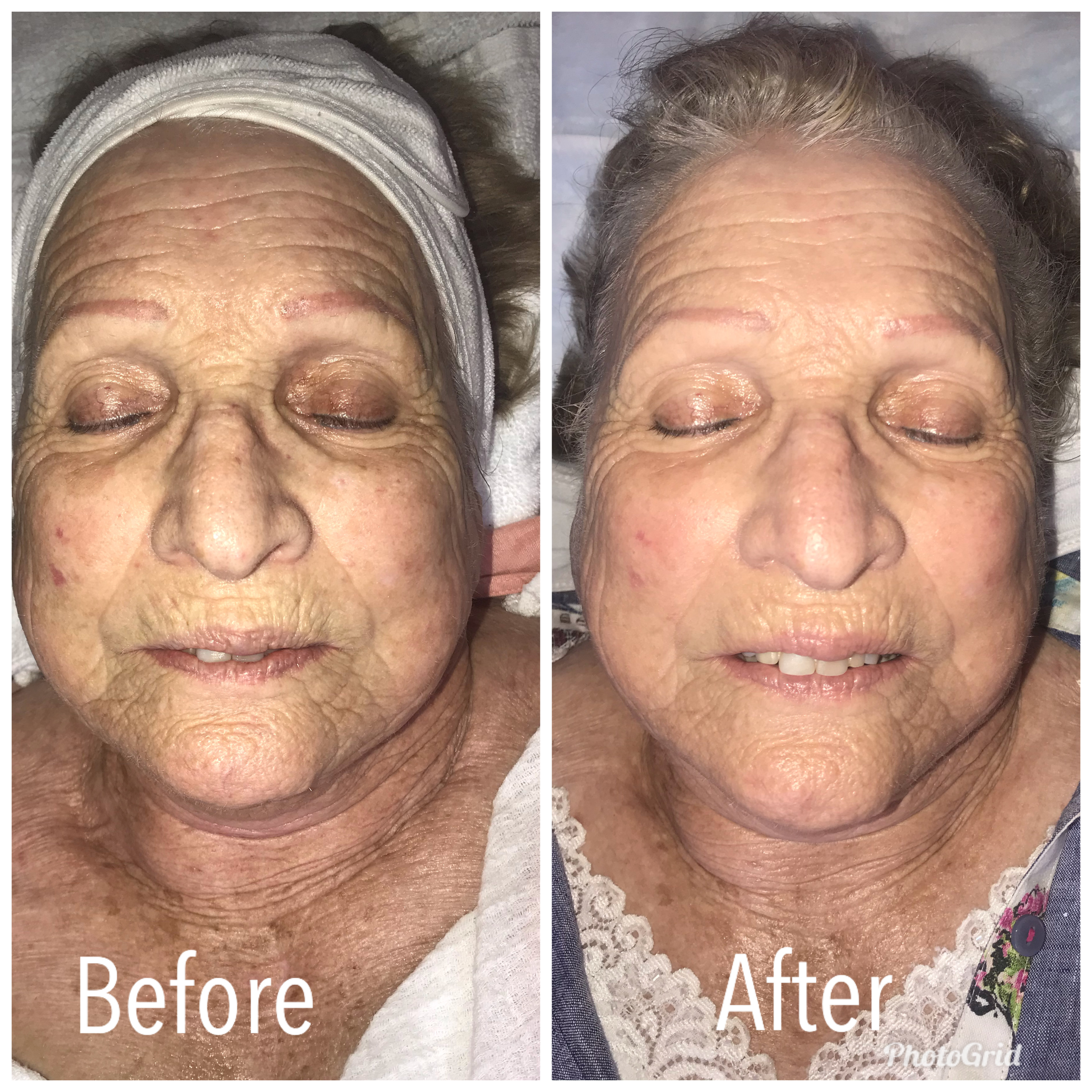 Ayurvedic Brightening