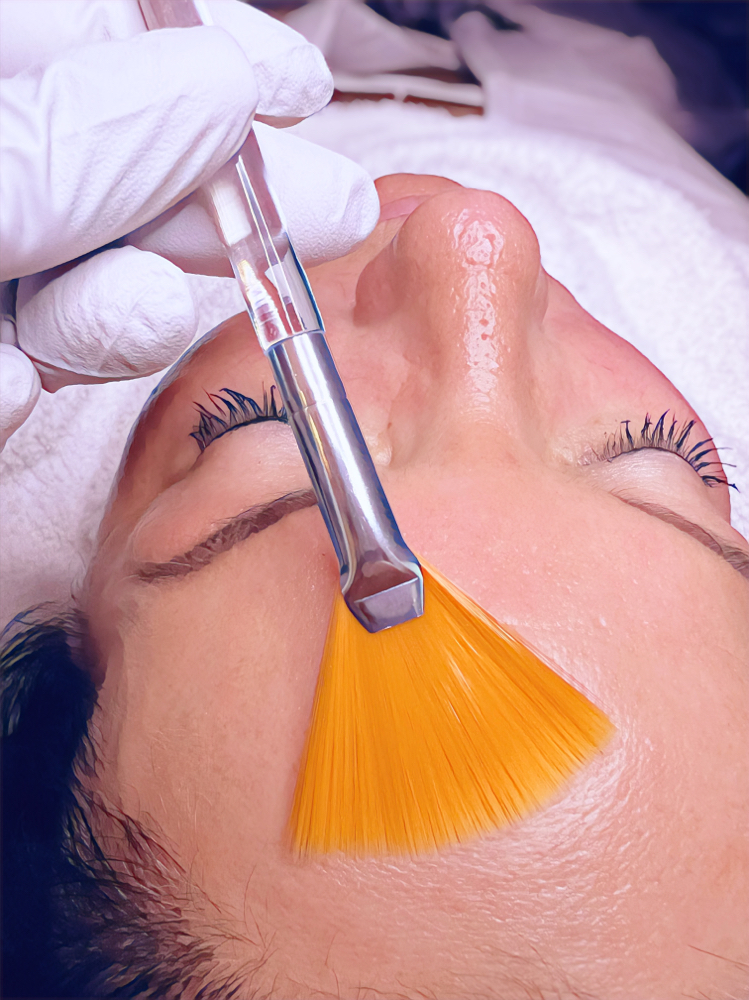 DERMAPLANE SOLO/Existing Clients