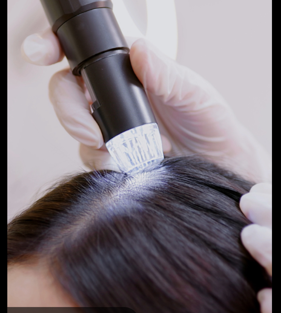 Scandanavian Scalp Treatment