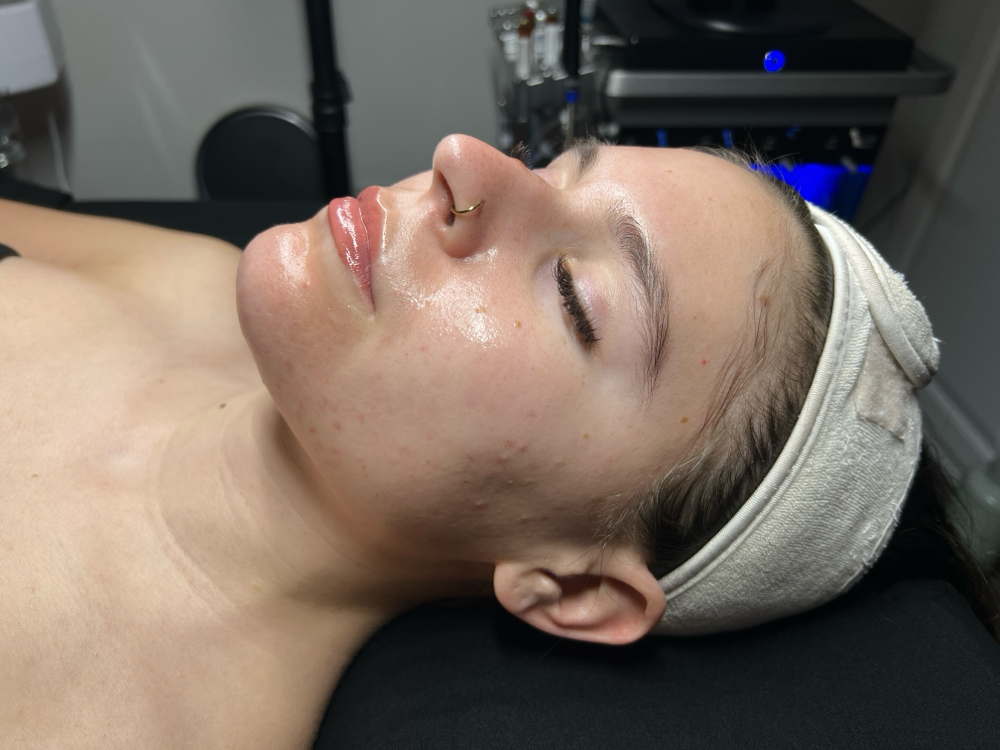 Signature Hydrafacial