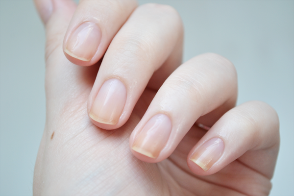 GEL REMOVAL