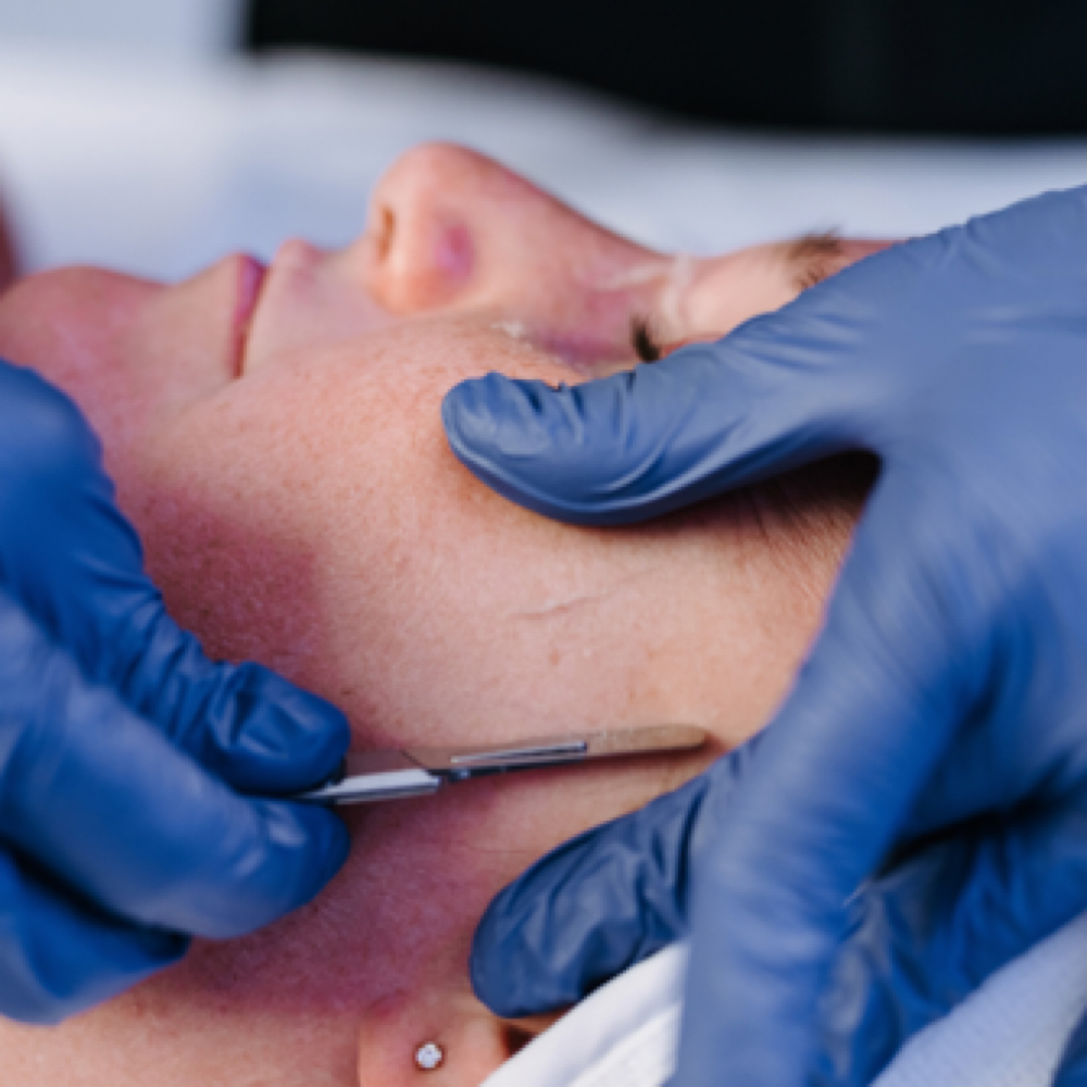 Express Dermaplane Facial at Starling Beauty in Benson, NC