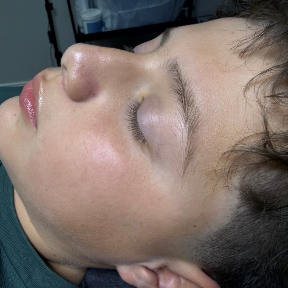 Youth Facial at Sol & Skin Wellness in Duncanville, TX