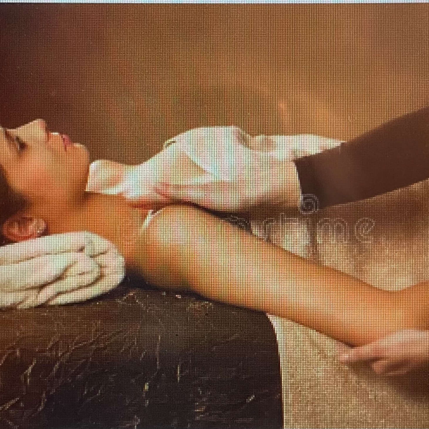 Arm Fascia Stripping