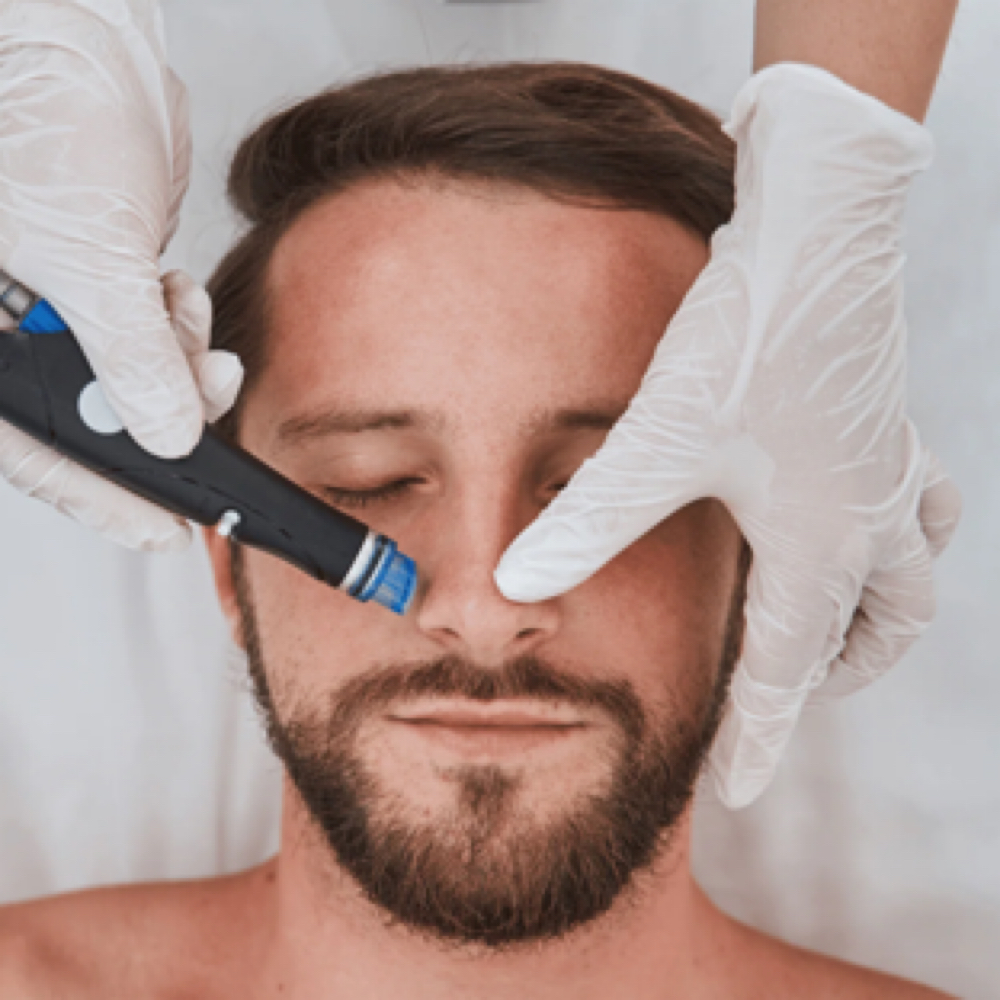 HydraDermabrasion at Beauty And Body in San Dimas, CA