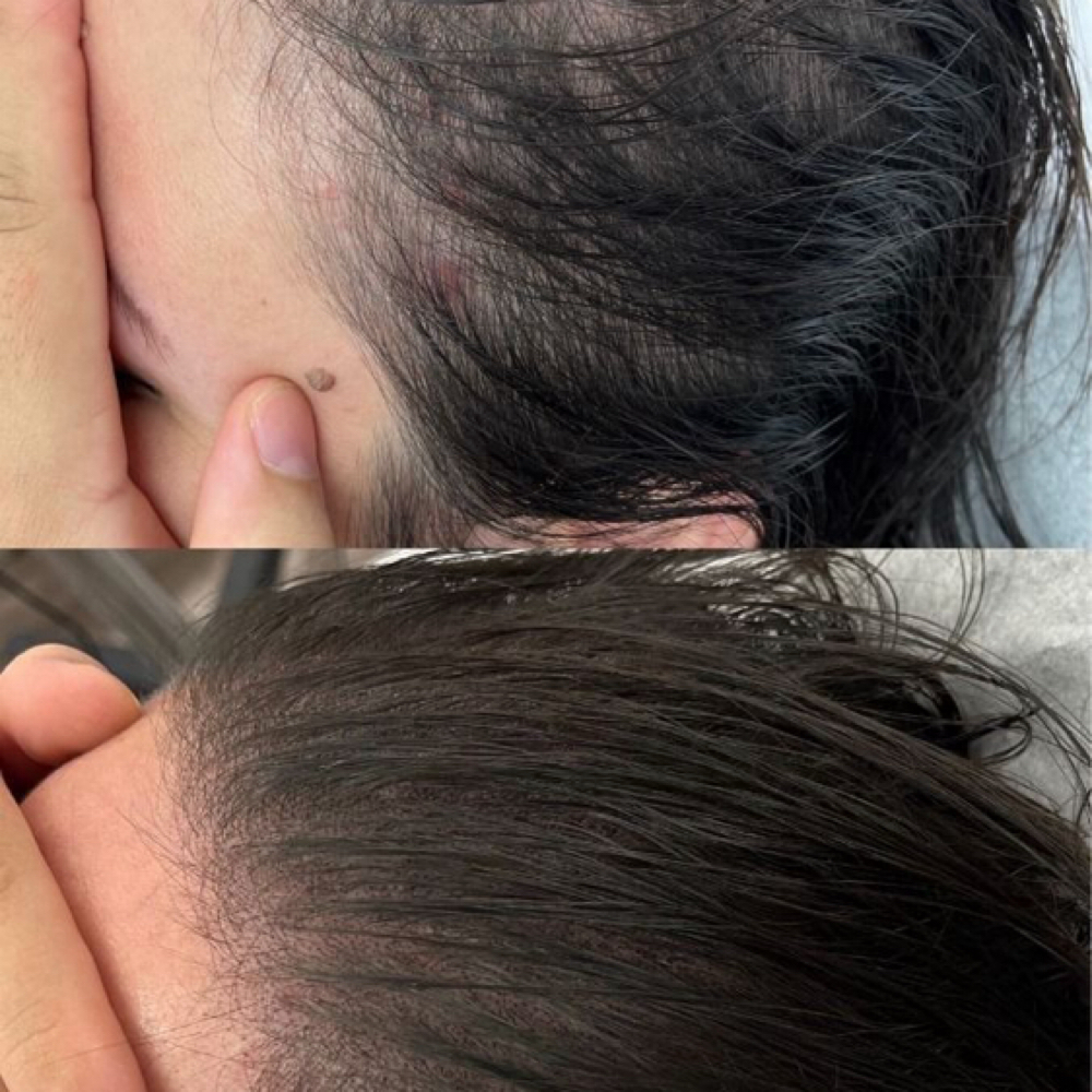 Scalp Micropigmentación at VELVET INK BY GISELA GALLARDO LLC in South Plainfield, NJ