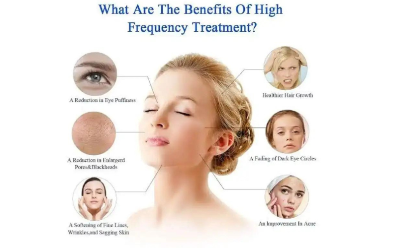 High Frequency Treatment