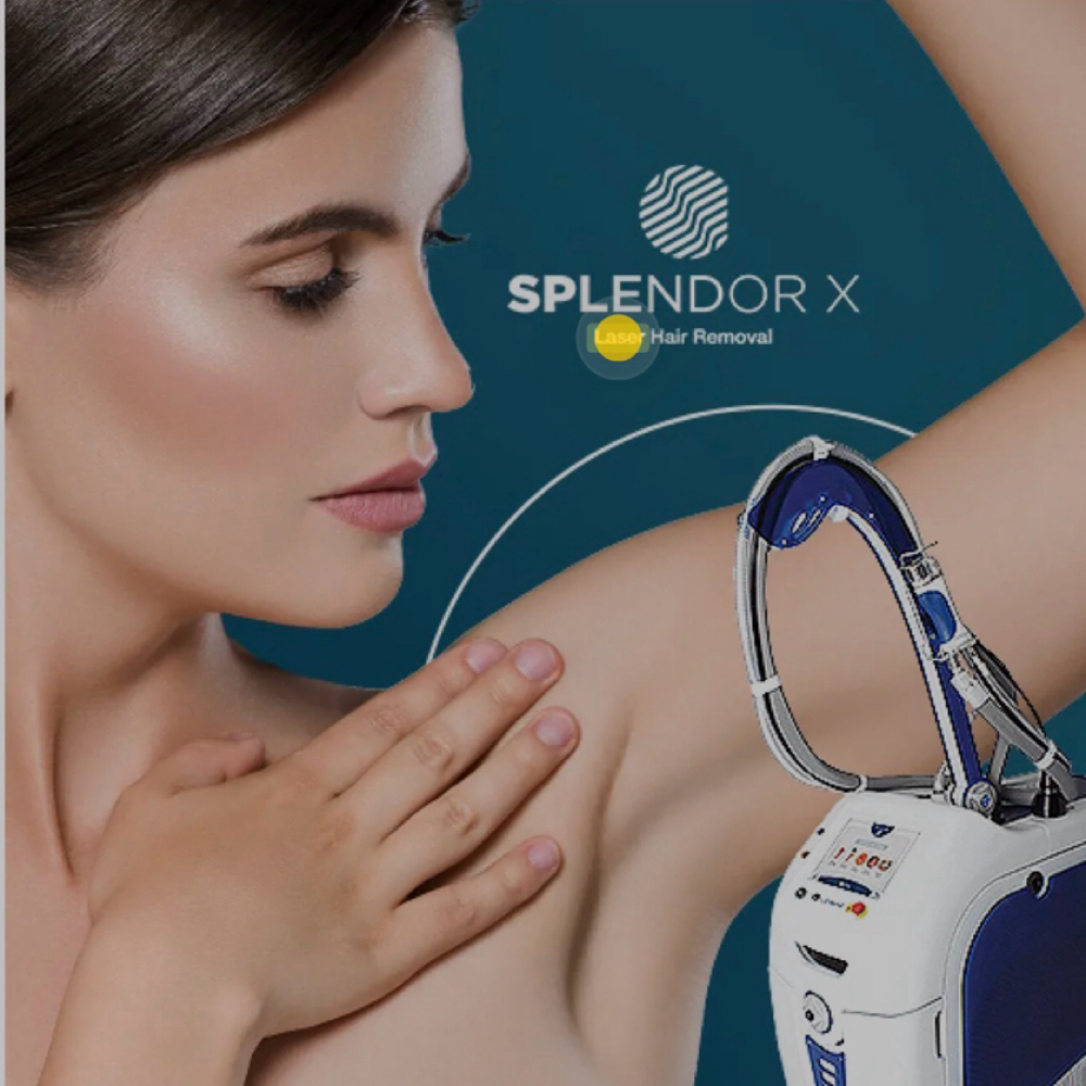 Laser Removal - Side-Burns at Be.You.tiful Forever in North Babylon, NY