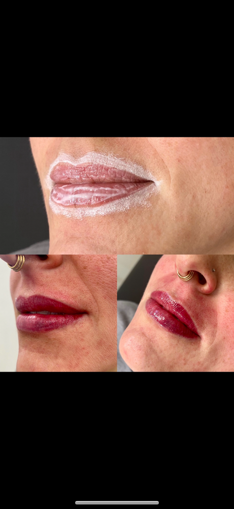 Yearly Touchup Lips