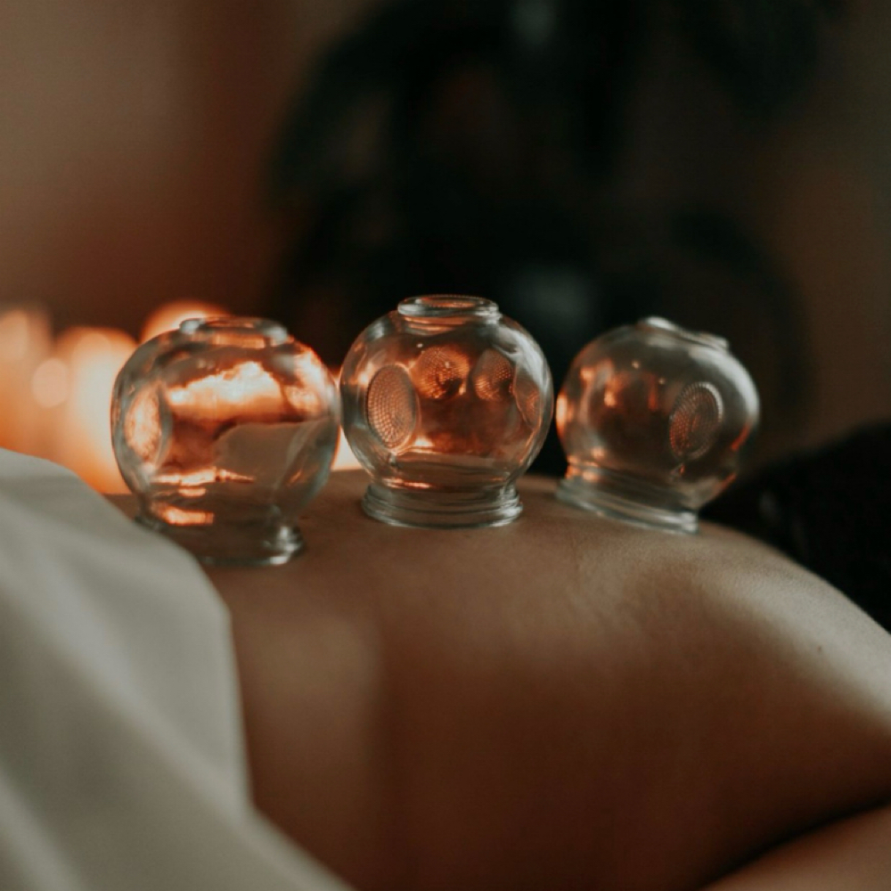 Cupping at Community Massage and Wellness Spa in Elizabeth, NJ