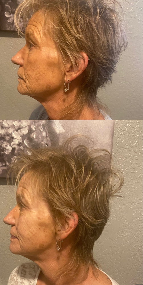 Full Face Contour