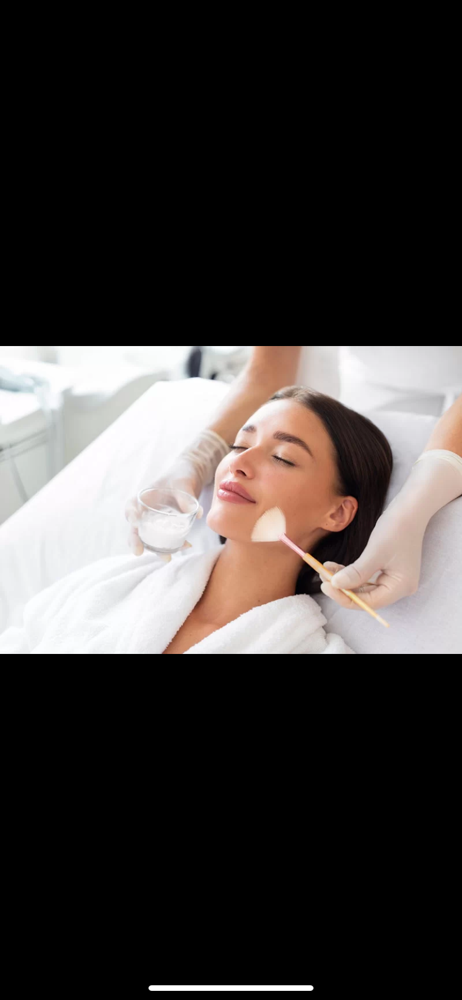 Chemical Peel