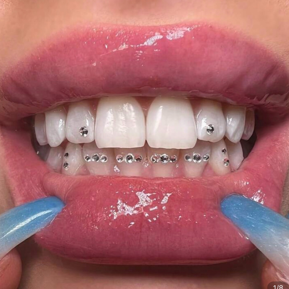 Tooth Gem App. Mini Freestyle Set at Icey Whites By Blondee in Lawrence, MA